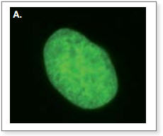 Figure 2. Live cell imaging of SNAPf Fusion proteins