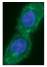 Figure 1: Live CHO-K1 cells transiently transfected with pCLIP-NK1R