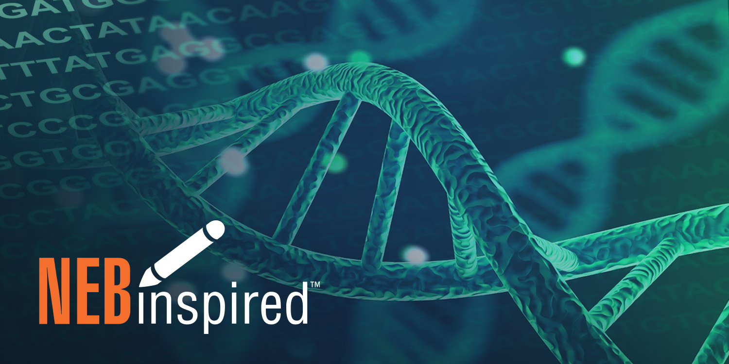 Proven tips for PCR primer design NEB