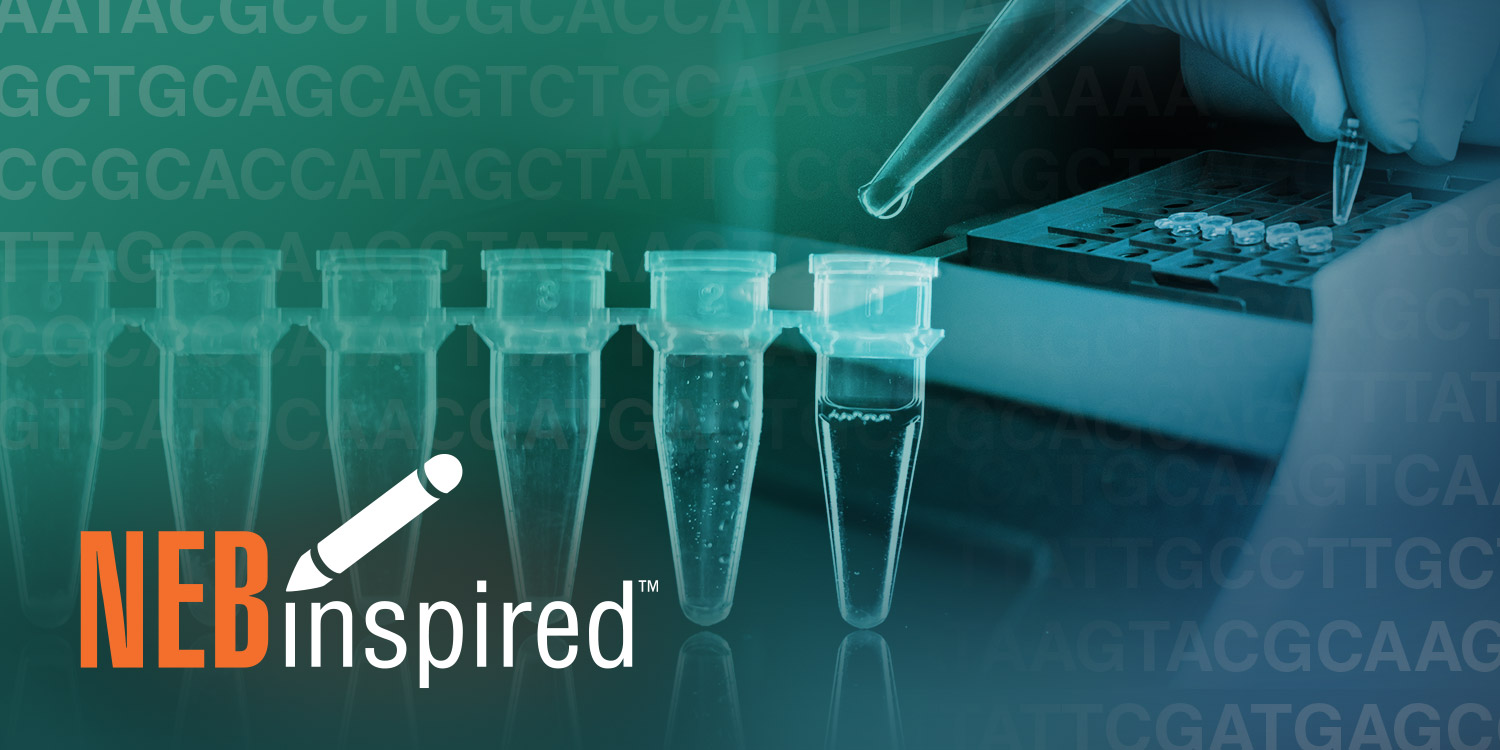 Four tips for PCR amplification of GCrich sequences NEB