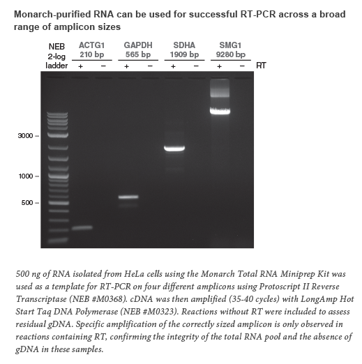 Total RNA Extraction and Purification NEB