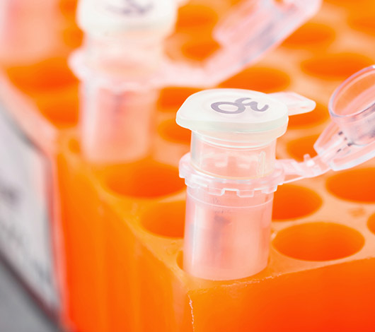 Close-up of test tubes in an orange rack with the NEBinspired logo