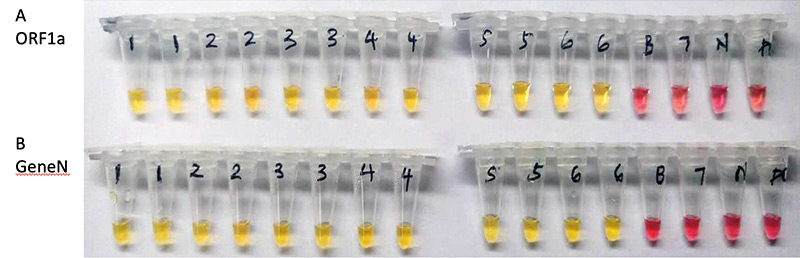 Colorimetric LAMP performed on COVID-19 patient samples