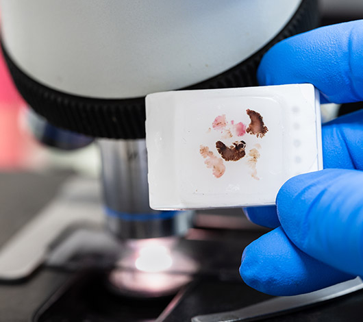 photograph of a blue gloved hand holding a slide with a tissue sample and an out of focus microscope in the background