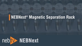 NEBTV_MagneticSeparationRack_1920