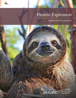 Protein Expression & Purification