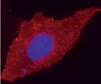 Figure 1: Live U2OS cells transiently transfected with pACP-ADRB2