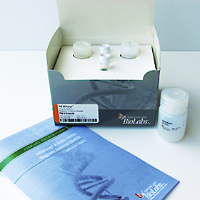 NEBNext Poly A mRNA Magnetic Isolation Module