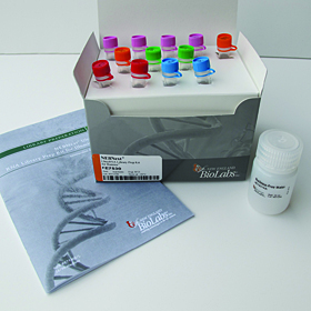 NEBNext Ultra RNA Library Prep Kit for Illumina