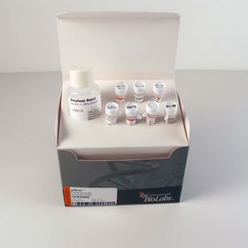 pMAL Protein Fusion and Purification System